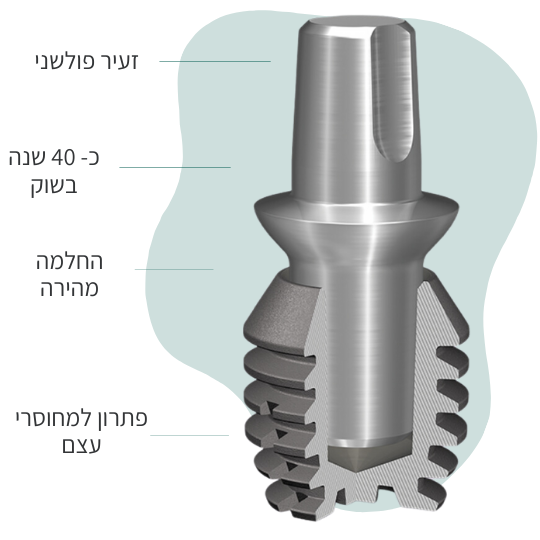שתלים קצרים : פתרון גדול בשתל קטן - השתלות שיניים בבאר שבע🦷