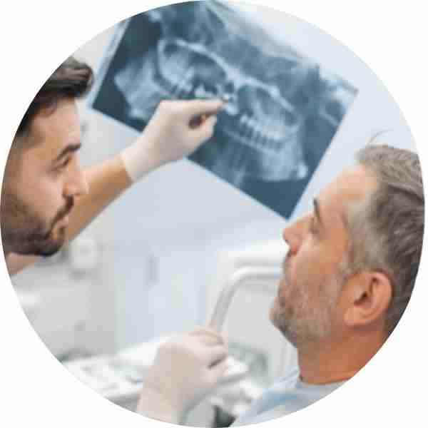 השתלה ושיקום